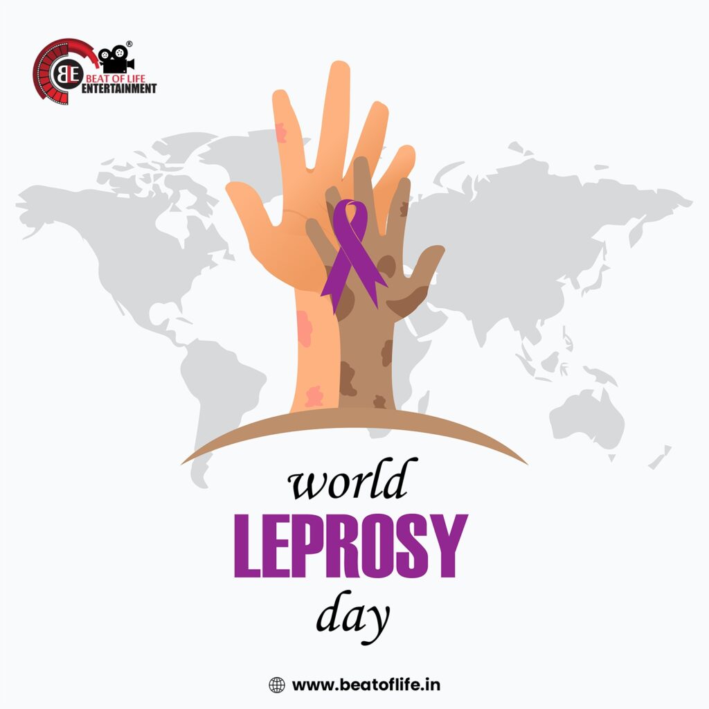 World Leprosy Day